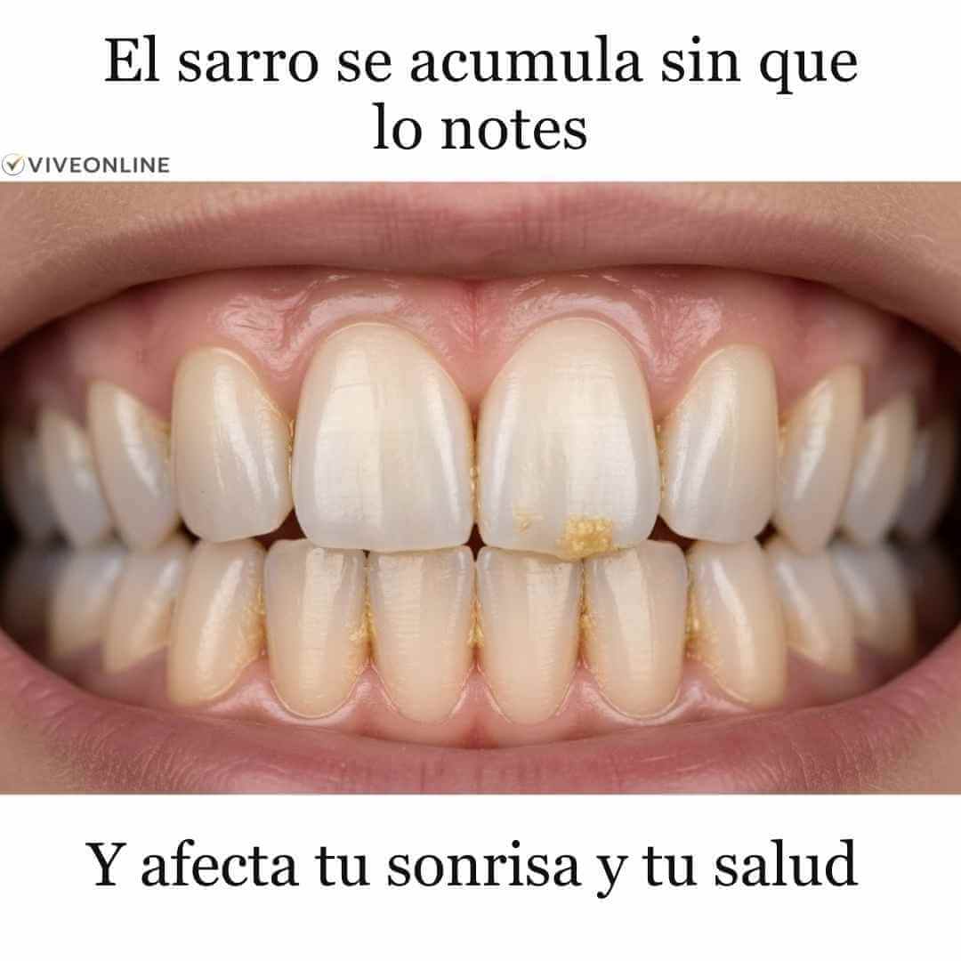 SoniClean Pro - Remueve sarro y manchas