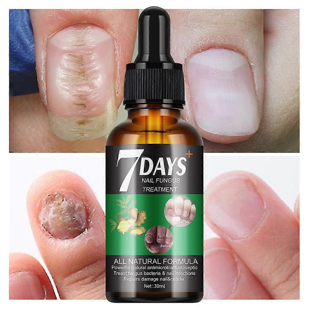 Serum 7 Días - Uñas más saludables y visiblemente renovadas en 7 días