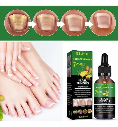Serum 7 Días - Uñas más saludables y visiblemente renovadas en 7 días