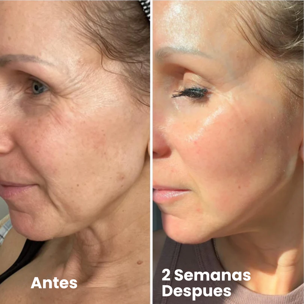 Retinal Shot – Reduce visiblemente arrugas y mejora la firmeza de la piel