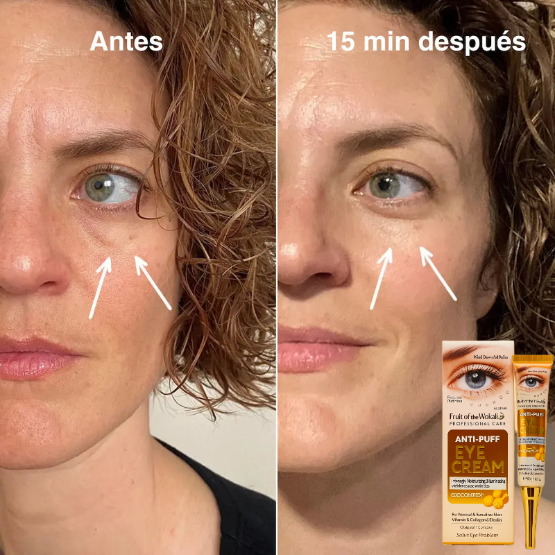 Wokali con Q10™ 2x1 – Reduce bolsas y rejuvenece tu mirada