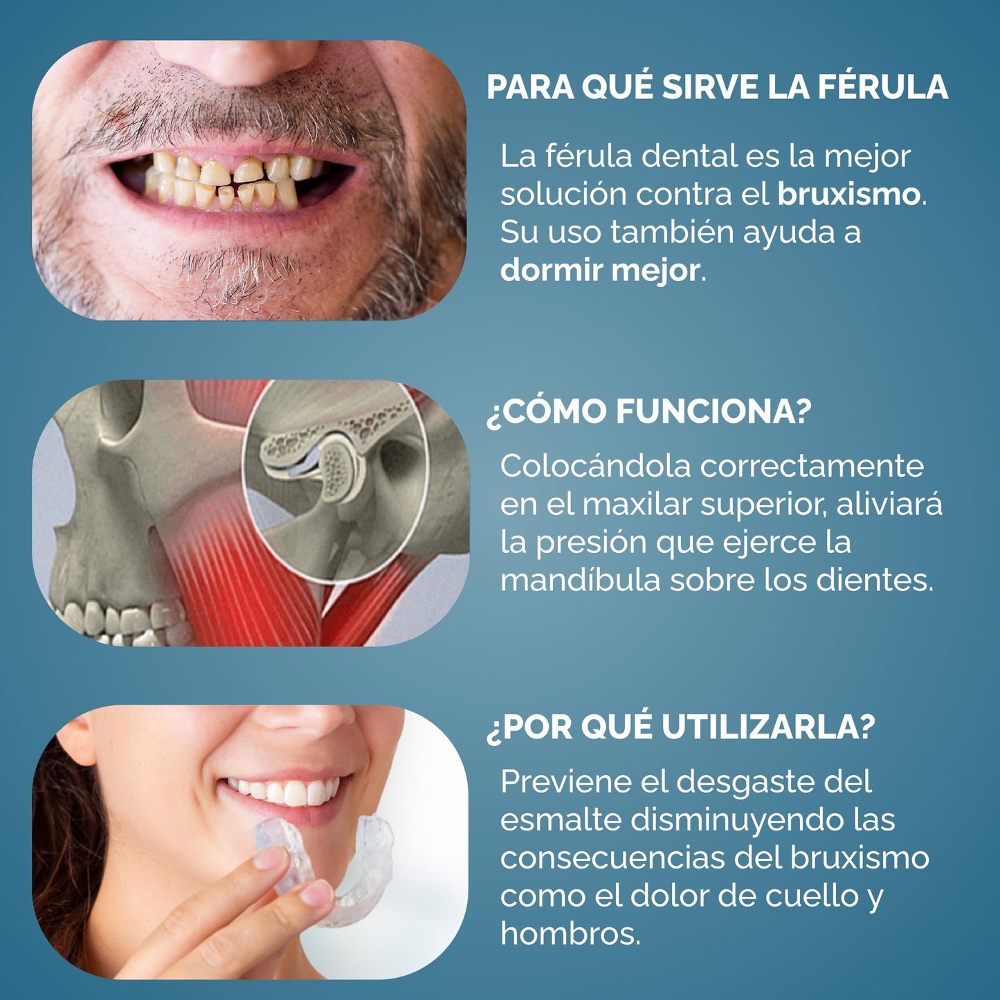 PLACA ANTI BRUXISMO APNEA Y RONQUIDO - 2X1