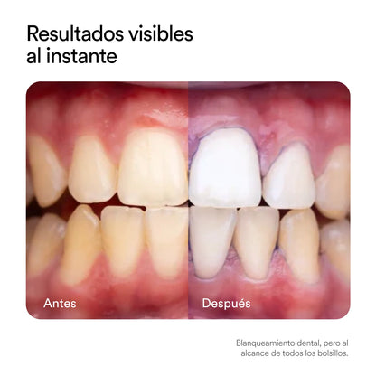 PASTA DENTAL BLANQUEADORA OBSESSIVE