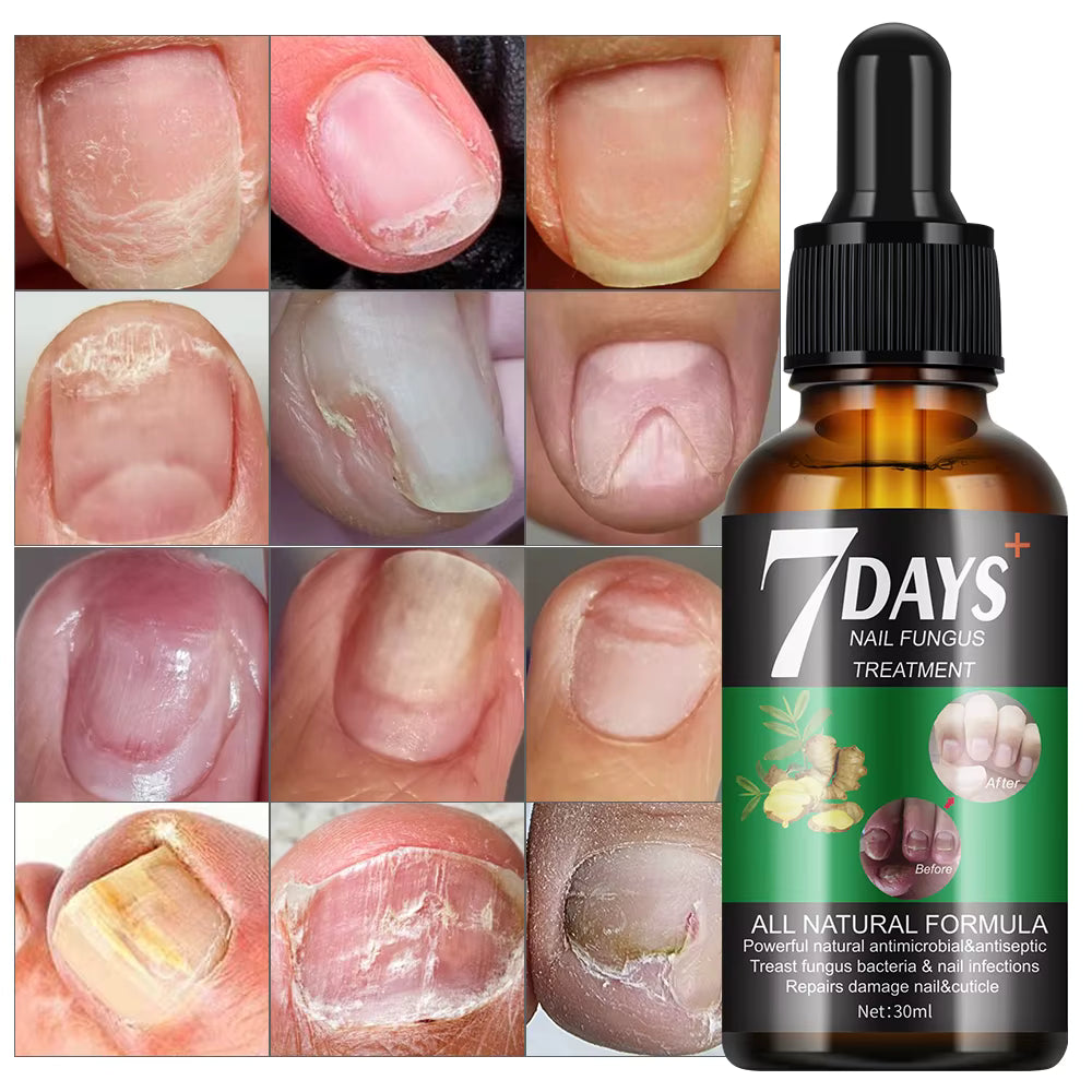 Serum 7 Días - Uñas más saludables y visiblemente renovadas en 7 días
