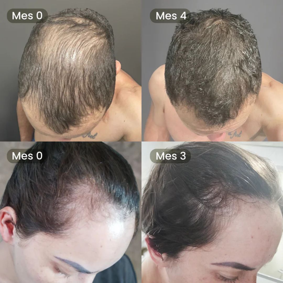 Aceite de Batana - Apoya el crecimiento y revitaliza tu cabello