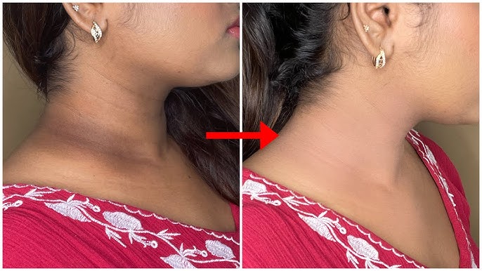 Gel Exfoliante - Mejora visiblemente el aspecto de zonas oscuras