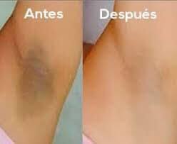 Gel Exfoliante - Mejora visiblemente el aspecto de zonas oscuras