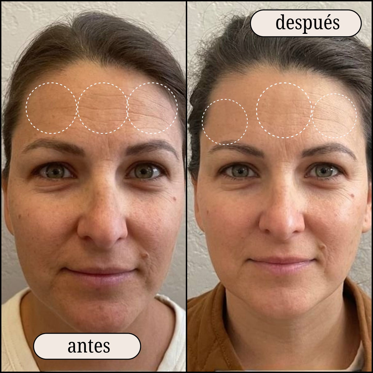 Retinal Shot – Reduce visiblemente arrugas y mejora la firmeza de la piel